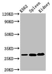 CA1 / Carbonic Anhydrase I Antibody