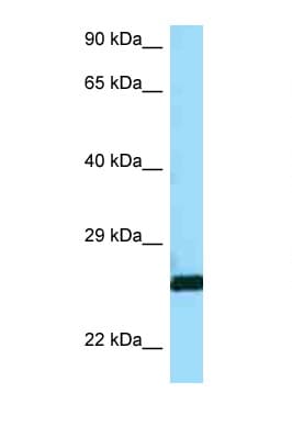 CTSH / Cathepsin H Antibody (aa258-307)