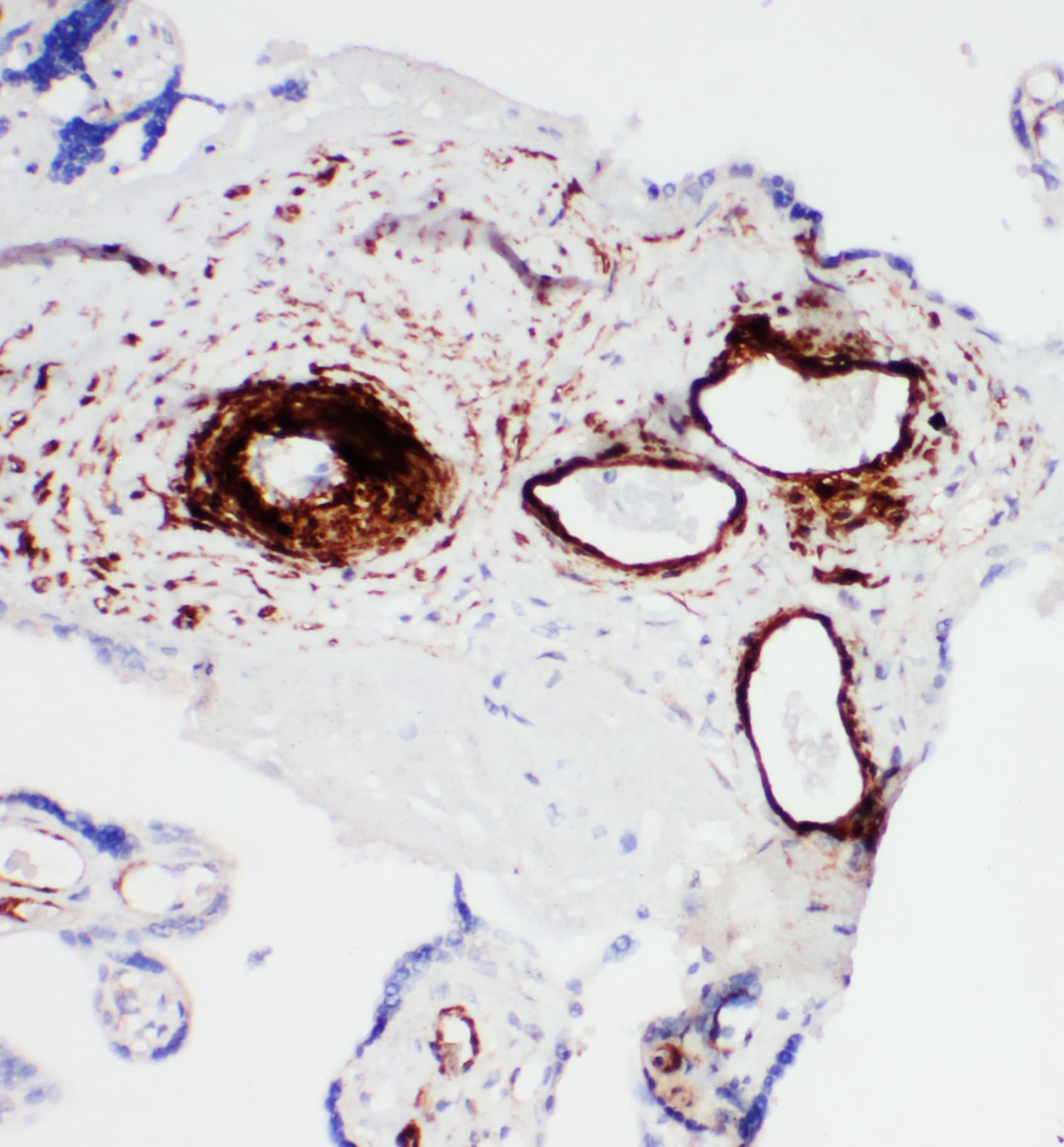 ATP2A1 / SERCA1 Antibody (aa665-680)