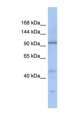 Polyclonal Rabbit anti-Human C20orf194 Antibody (aa322-371, WB)