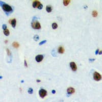 DLX3 Antibody (Internal)