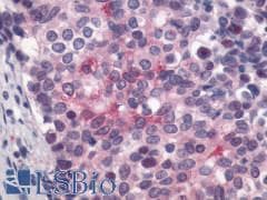 PathPlus™ Polyclonal Rabbit anti-Human LPAR4 / GPR23 Antibody (Cytoplasmic Domain, IHC)