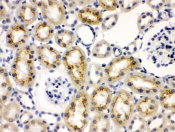 KRT19 / CK19 / Cytokeratin 19 Antibody