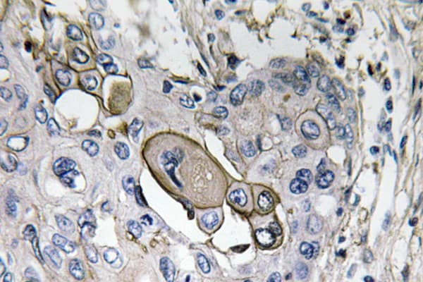 AQP5 / Aquaporin 5 Antibody (aa194-243)