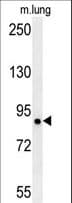 LRRC4B Antibody (aa81-110)