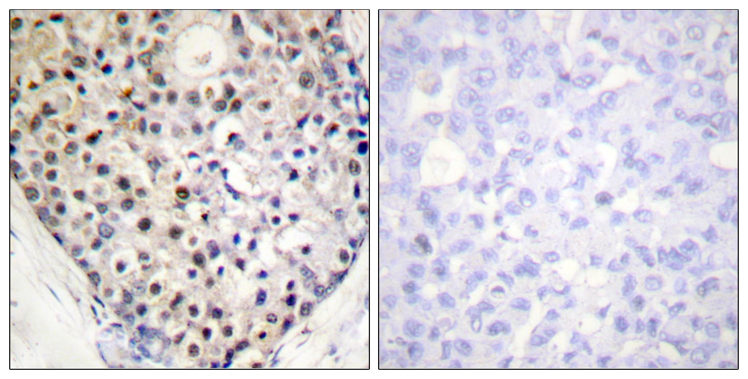 DDIT3 / CHOP Antibody (phospho-Ser30)
