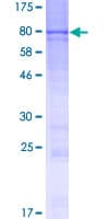 Human TBCCD1 Protein (Recombinant GST)