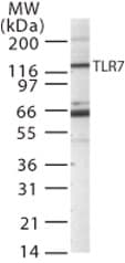 IHC-plus™ TLR7 / CD287 Antibody (aa706-728)