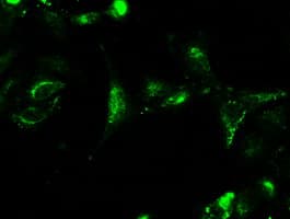 CTAG1B / NY-ESO-1 Antibody (clone OTI3C9)