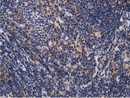 EPM2AIP1 Antibody (clone OTI2G3)
