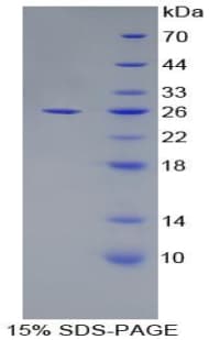 Mouse APOF / Apolipoprotein F (Recombinant His-T7)