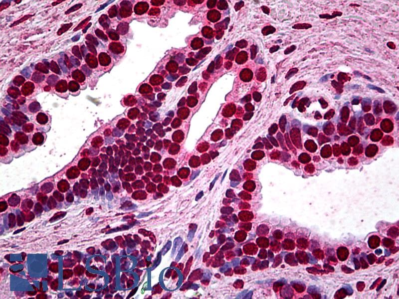 IHC-plus™ Monoclonal Mouse anti-Human MEF2A / MEF2 Antibody (clone 1D11, IHC, WB)