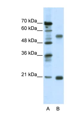 CHRNB3 Antibody (aa176-225)