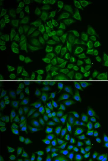 SGK1 / SGK Antibody