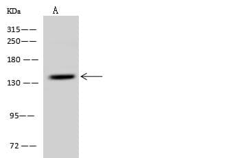 Polyclonal Rabbit anti-Human PDS5A Antibody (IF, WB)