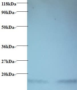 Hemoglobin Antibody