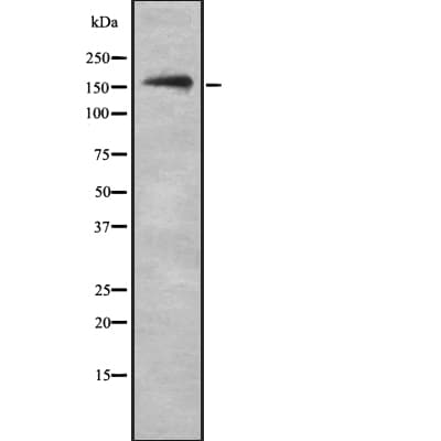 Polyclonal Rabbit anti-Human NKTR Antibody (WB)