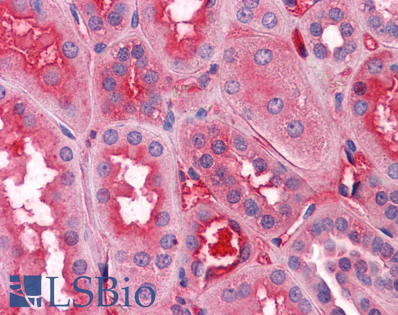 Polyclonal Sheep anti-Human F12 / Factor XII Antibody (IHC, WB)
