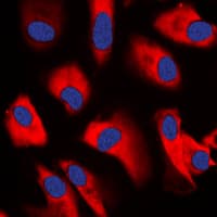 CDC37 Antibody (Internal)