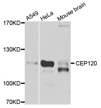 IHC-plus™ CEP120 Antibody