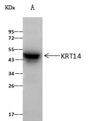 KRT14 / CK14 / Cytokeratin 14 Antibody (Preservative Free)