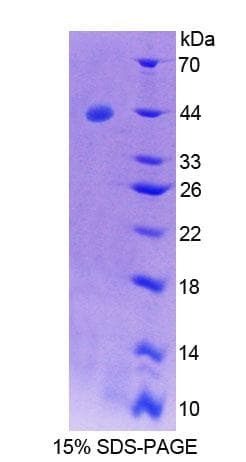 Human SYCN Protein (Recombinant His-GST)