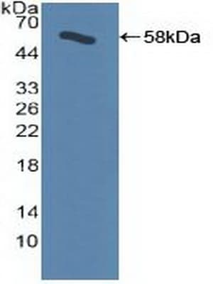 ADRBK1 / GRK2 Antibody (aa398-640, APC)
