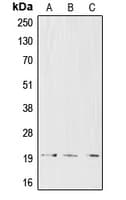 CD3D Antibody (Internal)