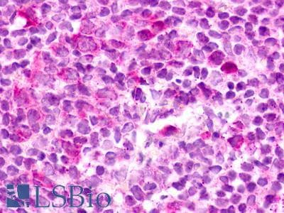 PathPlus™ GPR183 / EBI2 Antibody (Cytoplasmic Domain)