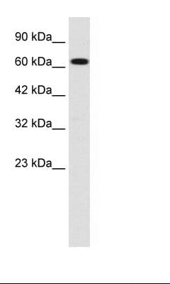 SCNN1B / ENaC Beta Antibody (C-Terminus)