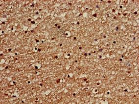 Polyclonal Rabbit anti-Human GOLGA3 Antibody (IHC, IF)