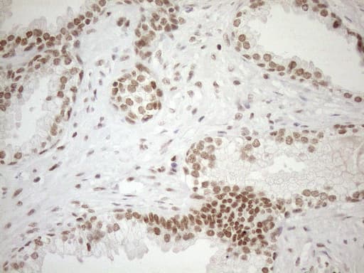 Monoclonal Mouse anti-Human UTP11L Antibody (clone OTI5F3, IHC, WB)