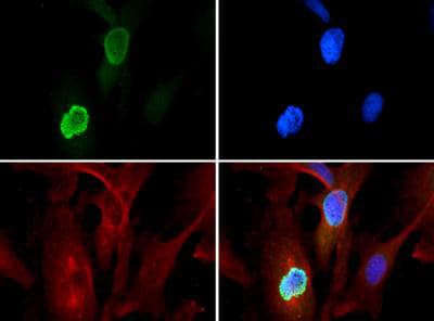 HIST3H3 Antibody (Me3-Lys56)