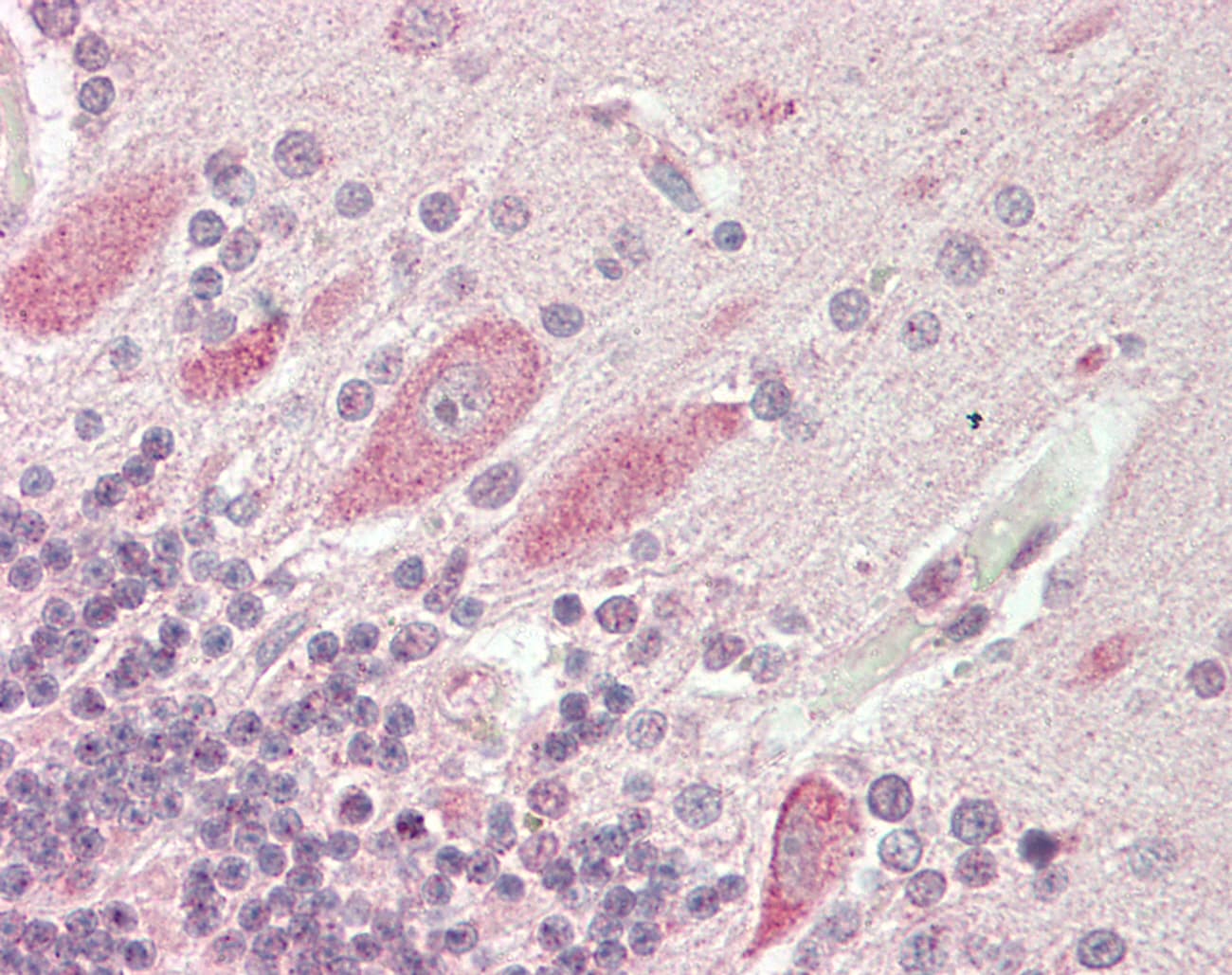 Polyclonal Rabbit anti-Human VAC14 / TRX Antibody (aa711-760, IHC, WB)