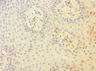 ADGRE5 / CD97 Antibody