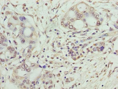Polyclonal Rabbit anti-Human SYNJ2BP / OMP25 Antibody (IHC, WB)