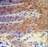 ATP12A Antibody (aa833-859)