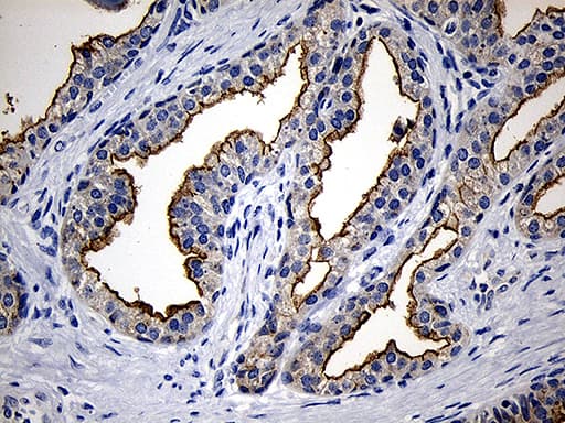 PIKFYVE / PIP5K Antibody (clone OTI1D2, Carrier-free)