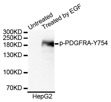 Polyclonal Rabbit anti-Human PDGFRA / PDGFR Alpha Antibody (phospho-Tyr754, WB)
