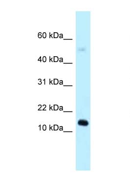 1110059E24Rik Antibody (aa39-88)