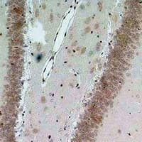 BEST2 / Bestrophin-2 Antibody