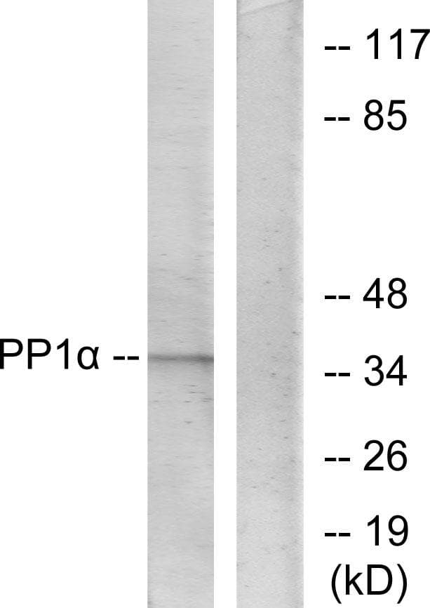 PPP1CA / PP1-Alpha Antibody (p320)