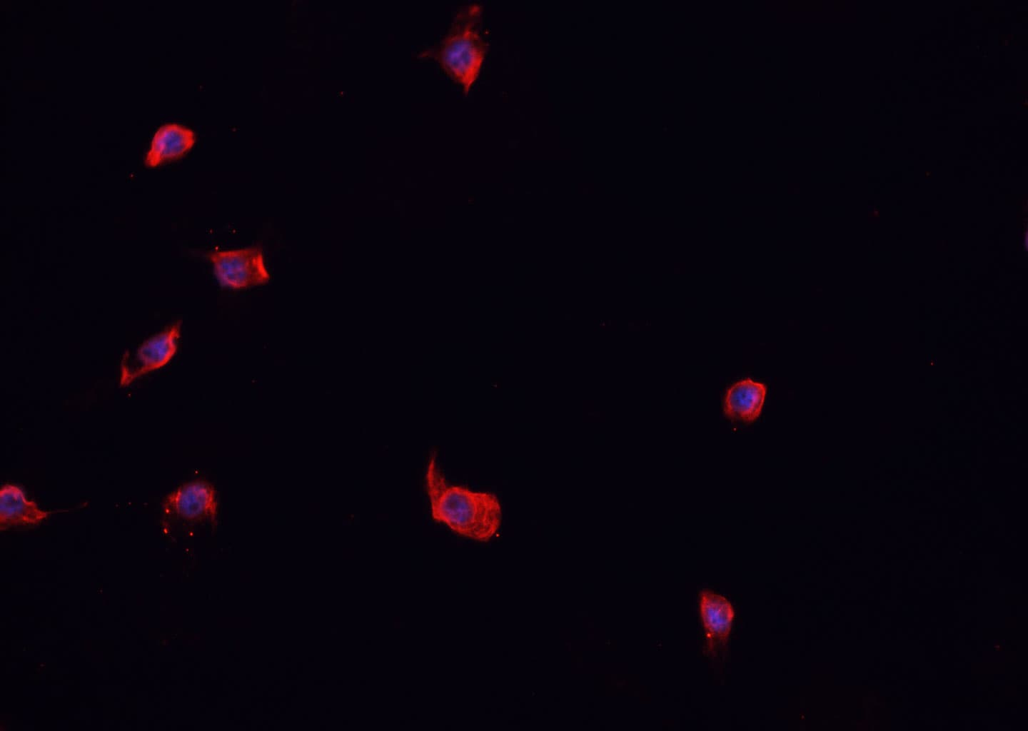 WC1 / ATP7B Antibody