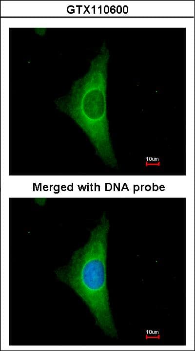 IHC-plus™ Polyclonal Rabbit anti-Human KRT20 / CK20 / Cytokeratin 20 Antibody (aa75-317, IHC, IF, WB)