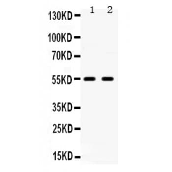 HTR2B / 5-HT2B Receptor Antibody (aa446-478)