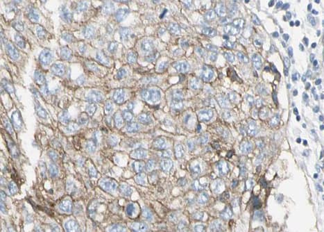 SERPINE1 / PAI-1 Antibody