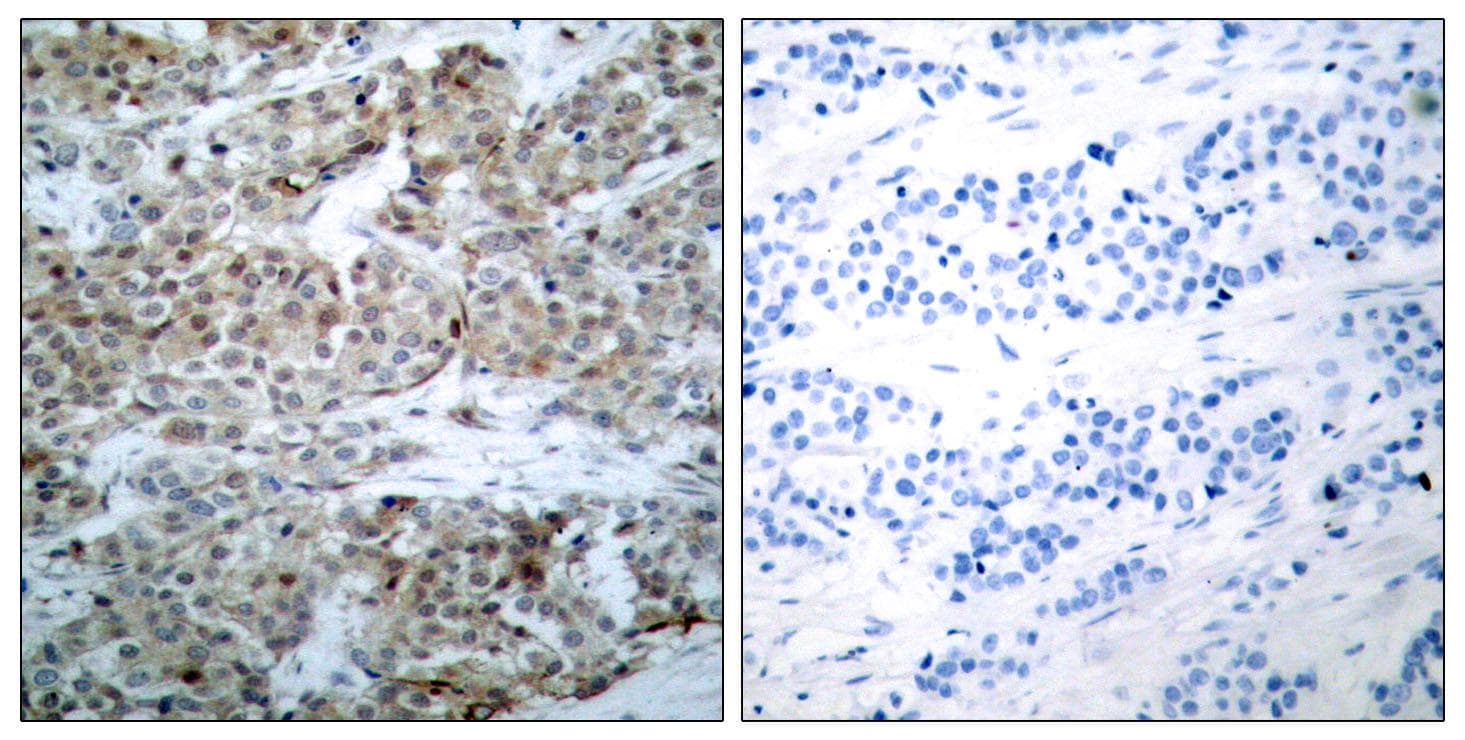 BAD Antibody (phospho-Ser112)