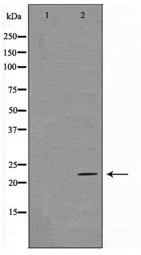 TNFAIP8 / SCC-S2 Antibody