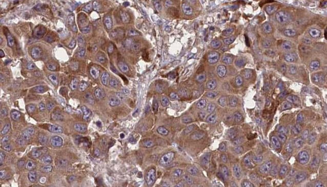 Polyclonal Rabbit anti-Human RP105 / CD180 Antibody (IHC, WB)