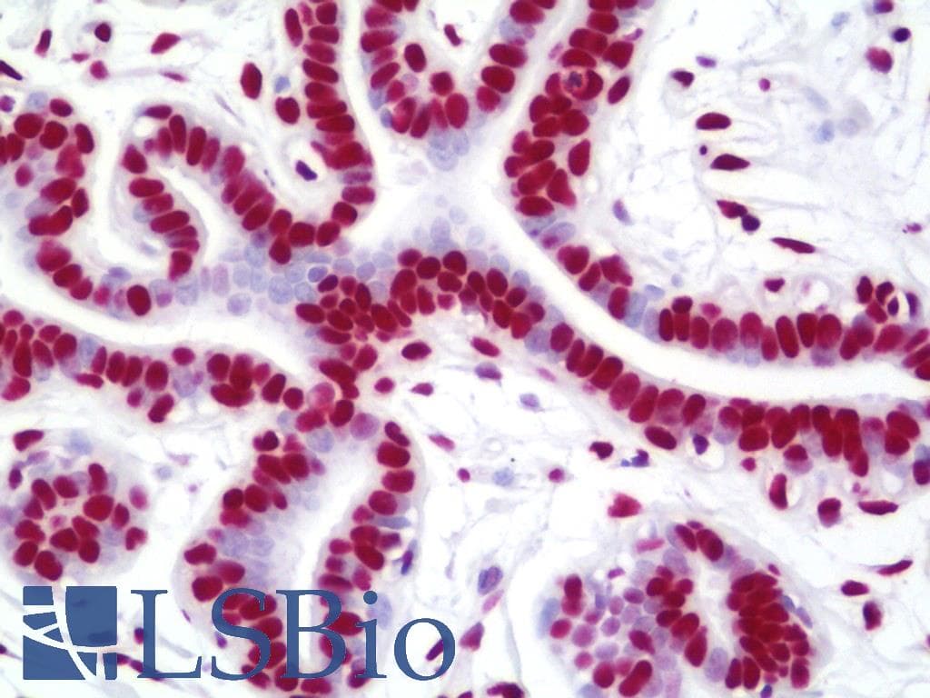 IHC-plus™ Polyclonal Rabbit anti-Human NUMA1 / NUMA Antibody (aa900-950, IHC, IF)